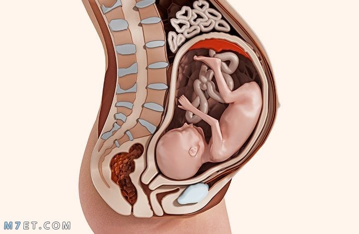 علاج نزول الجنين في الحوض