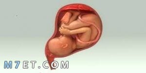 وضعية الجنين في الحمل
