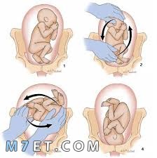 وضعية الجنين في الحمل