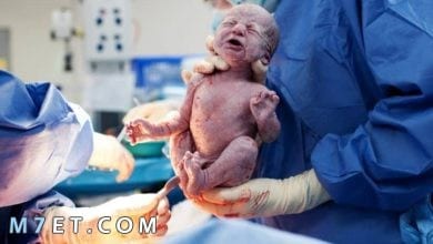 Photo of متى يحدث التبويض بعد الولاده القيصريه