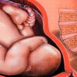 وضعية الجنين في الحمل وهل يمكن تغييرها