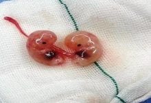 Photo of كيف اعرف ان الجنين نزل في الإجهاض وهل يحدث الإجهاض بسبب الأب أم الأم