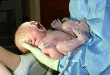 Photo of متى تشفى العملية القيصرية تماما ونصائح للمساعدة