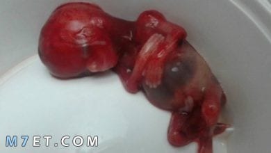 Photo of هل يمكن معرفة نوع الجنين بعد الاجهاض ؟