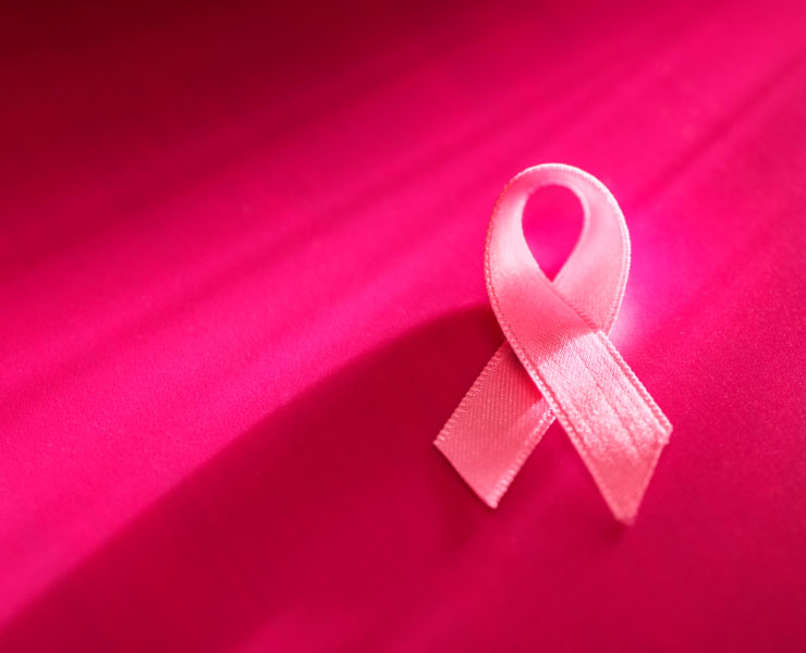 اعراض سرطان الثدي في سن العشرين