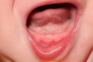 متى تبدأ أسنان الرضيع بالظهور .. وهل هي أصعب مراحل نمو الأطفال الأسنان عند الأطفال وأهم النصائح لسلامة مرحلة التسنين صورة رقم 4