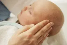 Photo of علاج قشرة الراس عند الاطفال