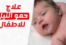 Photo of علاج حمو النيل للاطفال 