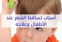 Photo of تساقط الشعر عند الاطفال
