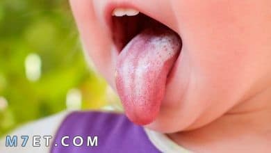 Photo of  فطريات الفم عند الاطفال وكيفية علاجها