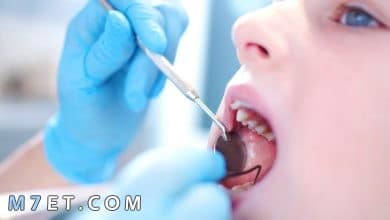 Photo of علاج تسوس اسنان الاطفال