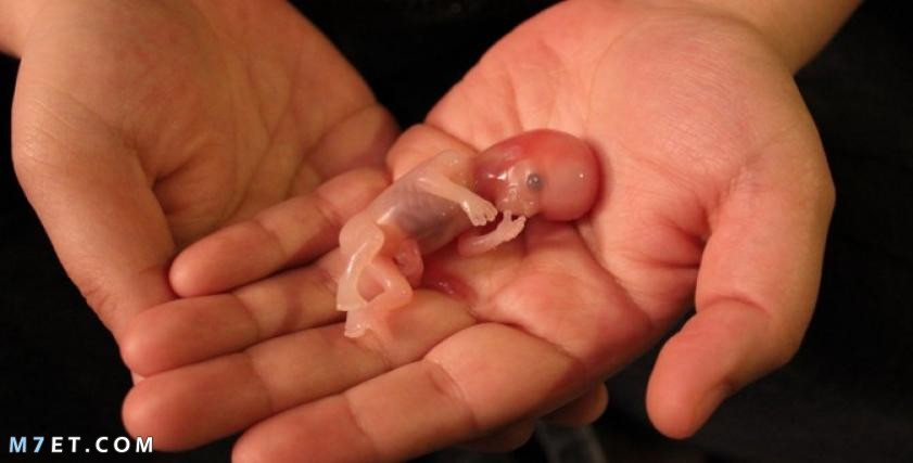اسباب اجهاض الجنين