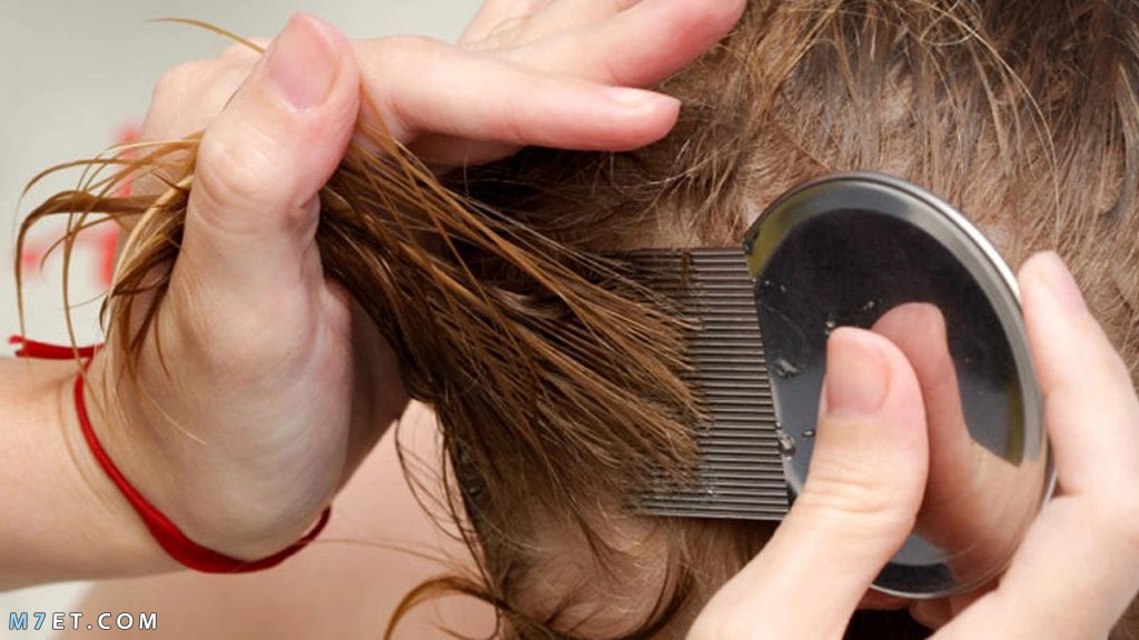 علاج تقصف الشعر عند الاطفال