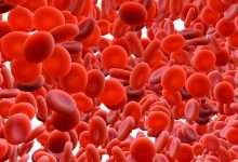 Photo of ارتفاع تحليل rbc في الدم والبول: 8 أسباب لارتفاع عدد خلايا الدم الحمراء في الجسم