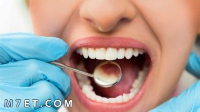 Photo of كيف تتخلص من تسوس الأسنان في خمس خطوات