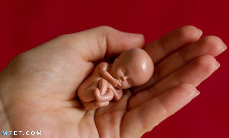 اسباب اجهاض الجنين