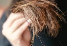 Photo of ما هو تقصف الشعر: 7 أنواع و7 أسباب منتشرة وطرق العلاج والوقاية المجربة