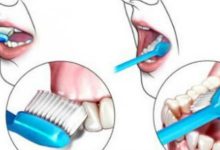 Photo of ما هو تنظيف الأسنان | أدوات تنظيف الأسنان | تنظيف الأسنان طبياً