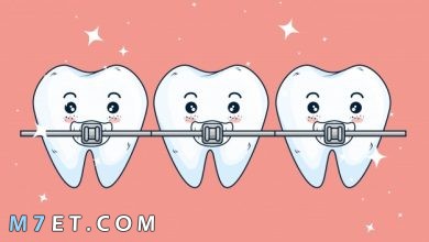 Photo of مراحل تقويم الأسنان هل تكون مؤلمة