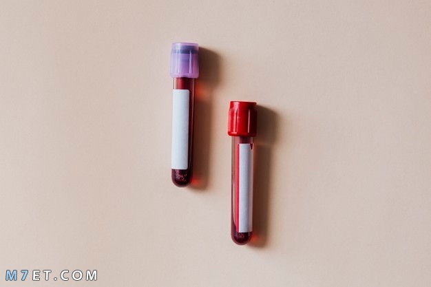 ارتفاع الهيموجلوبين والتبرع بالدم هل يوجد خطر عليك