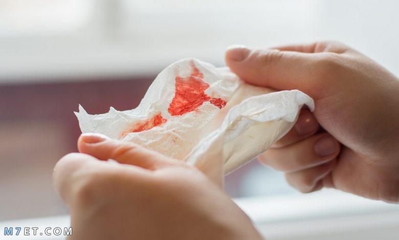 أسباب خروج الدم من الفم مع البلغم هل ذلك نذير مرض مزمن