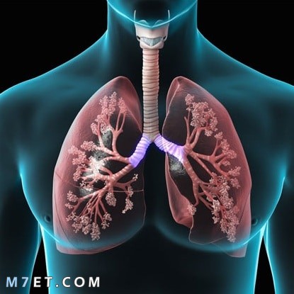 التهاب الجهاز التنفسي