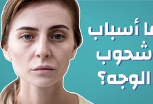 Photo of اسباب انتفاخ الوجه وأفضل وصفتين لعلاج تورم الوجه