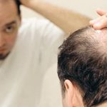 أسباب تساقط الشعر للرجال وطرق العلاج بالاعشاب