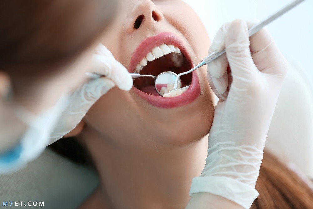 علاج تسوس الأسنان بالقرنفل
