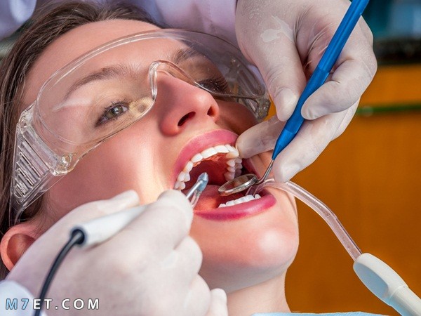 اضرار تنظيف الاسنان عند الطبيب