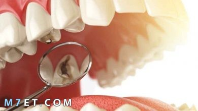 Photo of إزالة تسوس الاسنان| 11 طريقة للتخلص من التسوس نهائيا
