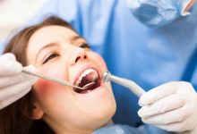 Photo of اضرار تنظيف الاسنان عند الطبيب| 9 نصائح بعد تنظيف الاسنان من الجير