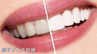 Photo of فوائد وأضرار تبييض الأسنان بالليزر لأسنان مثل اللؤلؤ