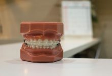 Photo of تقويم الأسنان | فوائد واستخدامات