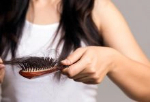Photo of أسباب تساقط الشعر الطبيعي وطرق العلاج بـ 4 طرق طبيعية