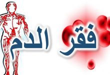 Photo of 5 نصائح لـ الوقاية من فقر الدم