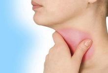 Photo of أسباب ألم في الحلق والعلاج بـ 8 طرق منزلية