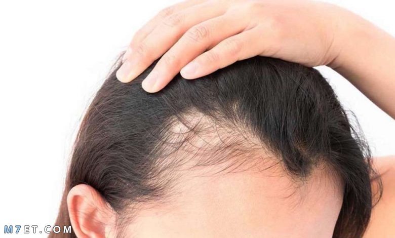 طريقة علاج الشعر الخفيف