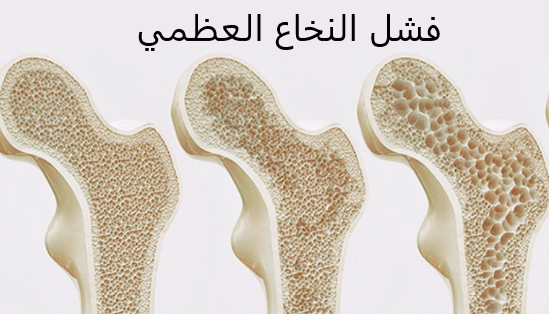 أعراض فشل النخاع العظمي