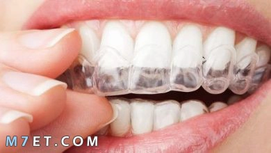 Photo of طريقة لتبييض الاسنان في يوم واحد