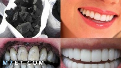 Photo of طرق جديدة لتبييض الأسنان