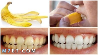Photo of فوائد قشر الموز لتبييض الاسنان خلال دقائق