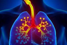 Photo of علاج التهاب القصبة الهوائية بالعسل و3 أعشاب طبيعية