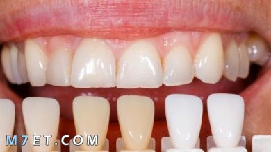 Photo of أسباب تغيّر لون الأسنان إلى اللون الرمادي والشفاف