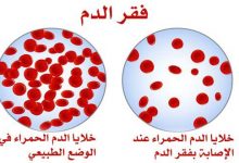 Photo of انواع فقر الدم وأشهر 10 أعراض للإصابة بفقر الدم