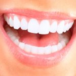 طرق تبيض الأسنان طبيعيًا | أبسط الطرق التي يمكنك القيام بها