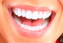 Photo of طرق تبيض الأسنان طبيعيًا | أبسط الطرق التي يمكنك القيام بها