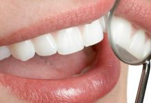 Photo of طرق الوقاية من تسوس الاسنان| 7 نصائح للحفاظ على صحة الأسنان