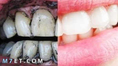 Photo of افضل طريقة لتبيض الاسنان