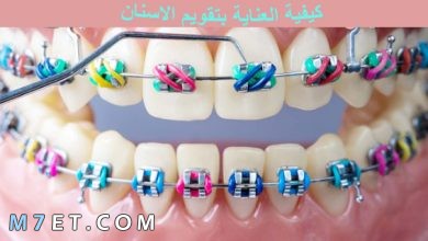 Photo of كيفية العناية بتقويم الاسنان